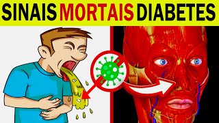 7 SINAIS MORTAIS de DIABETES que Você Não Pode Ignorar Cetoacidose Diabética [upl. by Jesse]