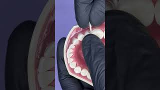 Class II cavity preparation tips and tricks Protecting the adjacent dentist dentistry [upl. by Oinimreh]