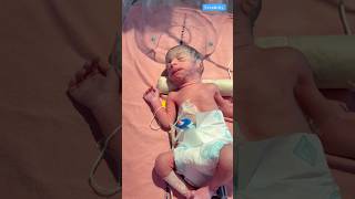 Low Birth weight Newborn medical viralvideo [upl. by Yensehc]