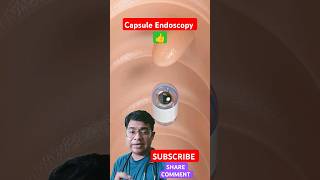 What is Capsule Endoscopy healthsciences endoscopy science [upl. by Jerrie]