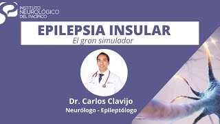 Epilepsia de la Insula  Gran imitadora [upl. by Sorilda]