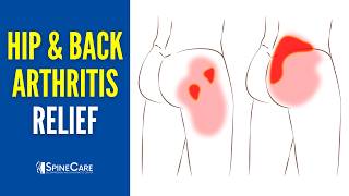 How to QUICKLY Relieve Hip and Back Arthritis Pain [upl. by Craner689]