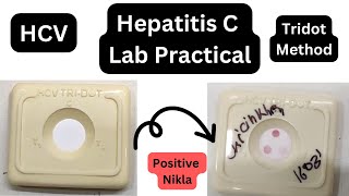 HCV test practical  Tridot method  Procedure  Hepatitis C Virus  लैब में कैसे लगता है [upl. by Tzong]