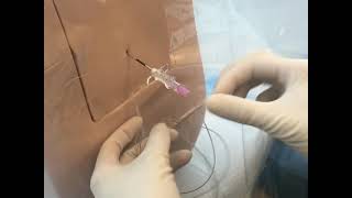 Neuraxial Task Trainer Demonstration  Epidural Anesthesia [upl. by Delcina]