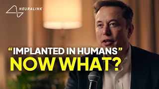 Inside the FIRST Human Brain Implant Trial Elon Musks Neuralink Makes History [upl. by Ecinna418]