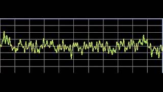 Vision Disorders  Rife Frequencies [upl. by Nairret236]