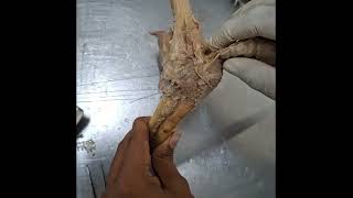 Elbow Joint and its movements [upl. by Notaes]