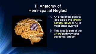 Cognition 3 6 Hemispatial Neglect amp Simultagnosia [upl. by Ettelloc]