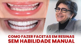 COMO FAZER FACETAS EM RESINAS SEM HABILIDADE MANUAL  Mylene e Renato [upl. by Bannasch134]