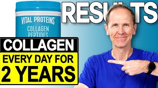 Vital Proteins Collagen Peptides  Results After 2 Years [upl. by Kcirted]