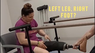 Inspiring First Steps ErintheamputeeQTs Temp Prosthetic Experience [upl. by Jake]