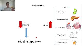 21pathogenese acidocetose [upl. by Liryc]