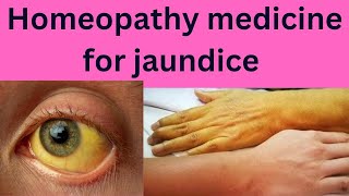 Homeopathy medicine for jaundice  jaundice treatmentjaundice managementjaundice medicinejaundice [upl. by Gent720]