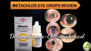 Metachlor Eye Drops Full Review  DexamethasoneChloramphenicol [upl. by Lovett]