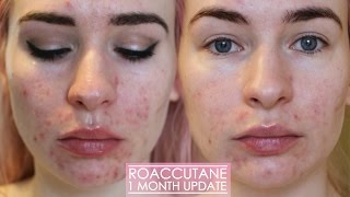 1 MONTH ROACCUTANE UPDATE  Side effects amp my skin now [upl. by Deane]