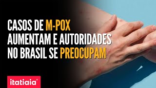 MINISTÉRIO DA SAÚDE VAI SE REUNIR PARA DISCUTIR SOBRE AUMENTO DE CASOS DE MPOX NO BRASIL [upl. by Valerle]