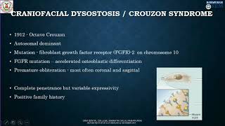 Crouzon Syndrome  Craniofacial Dysostosis Divya B  Department of oral Pathology amp Microbiology [upl. by Egidius]