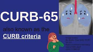 CURB65 score for Pneumonia  Pneumonia tests  Severe Pneumonia  Danger of Pneumonia [upl. by Idzik392]