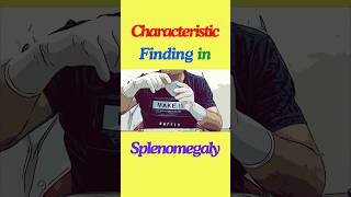 What is the characteristic finding in splenomegaly shorts spleen splenomegaly anatomy [upl. by Aillimac865]