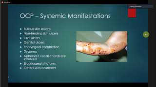 Ocular Cicatricial Pemphigoid David S Chu [upl. by Ameyn]