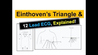 What does Einthovens Triangle entail and what is the process for creating a 12Lead ECG [upl. by Kcirdahs687]