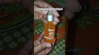 Best Serum For Dark Spot  Review Himalaya  Viral  Shorts 💖💖 [upl. by Ruddy]