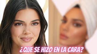 Kendall Jenner la nueva imagen de LOréal  los fans sospechan que se operó la nariz y los ojos [upl. by Carey]