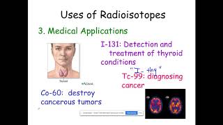 Uses of Radioisotopes [upl. by Suiluj]