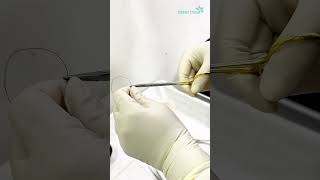 Biopsy for histopathology  Dhaka Dermatology Institute  LaserTreat [upl. by Ylrevaw]