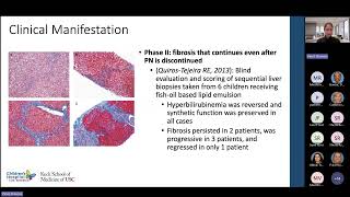 Intestinal Failure Associated Liver Disease Pediatric Grand Rounds 9132024 Meeting Recording [upl. by Berrie]