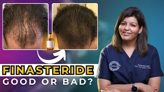 Hair loss मैं FINASTERIDE कितना जरूरी है  Right Age to Start Finasteride  Dr Nandini Dadu [upl. by Lednahs228]