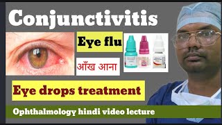 conjunctivitis  eye flu  conjunctivitis treatment  conjunctivitis eye drops  conjunctivitis [upl. by Anilev]