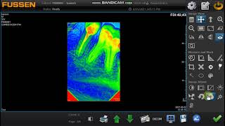 Fussen sensor software  editing xrays [upl. by Vasquez]