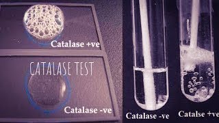 Catalase test principle and method an easy way to understand in Hindi and Urdu [upl. by Nosloc]