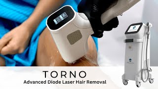 Torno  Advanced Diode Laser Hair Removal System [upl. by Aniral]