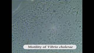 Motility of Vibrio cholerae [upl. by Ocnarfnaig]