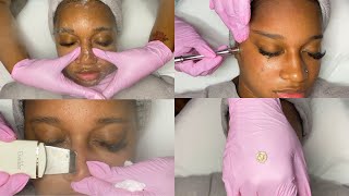 Summer Glow Facial w Microdermabrasion  GlamByLiaLeigh [upl. by Haizek850]