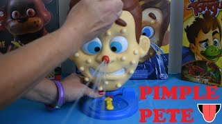 Pimple Pete Game Set Up Instructions And Demonstration [upl. by Ahseim]