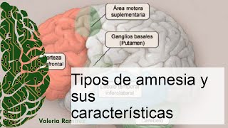 Descubre los Tipos de Amnesia y sus Características Todo lo que Necesitas Saber [upl. by Rainwater7]