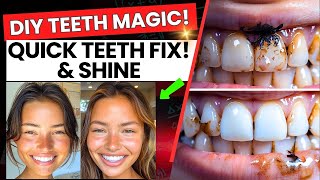 Fast Teeth Whitening Hacks You Can Do at Home Yellow Teeth to White 🦷 [upl. by Loftis]