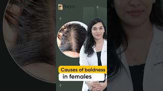 Causes of baldness in women  Hair fall treatment in Hyderabad  Dr Ravali Yalamanchili [upl. by Orford]