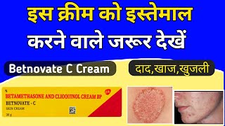 Betnovate c skin cream review  Betnovate c lagane se kya hota hai [upl. by Medwin]