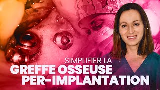 Simplifier la greffe osseuse perimplantaire [upl. by Marcello]