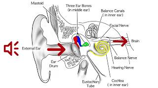 Hearing Loss Due to Aging A Common Problem [upl. by Einnal]