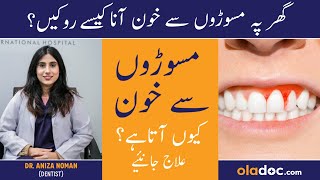 Masudo Se Blood Aane Ka Ilaj  Gums Bleeding Treatment In Urdu Danto Se Khoon Ane Ka Wajah Aur Ilaj [upl. by Falzetta]