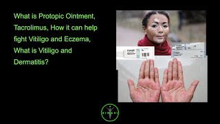 What is Protopic Ointment Tacrolimus How it can help fight Vitiligo and Eczema What is Vitilig [upl. by Htaeh499]