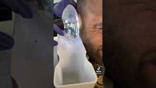 Fighter with cauliflower ear gets earwax removed with Earigator at Memorial Hearing Houston [upl. by Airrehs99]