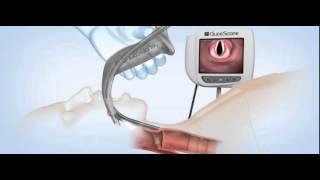 GlideScope Titanium Video Laryngoscopes Demonstration [upl. by Anaujat]