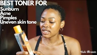 SKIN DOCTOR TONER REVIEW FOR CLEARING PIMPLES SUNBURN ACNE ETC [upl. by Lleval751]