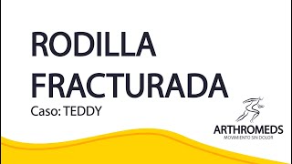 Caso de rodilla fracturada  Teddy Clínica ARTHROMEDS [upl. by Denney355]